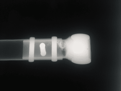 NDT x-ray component